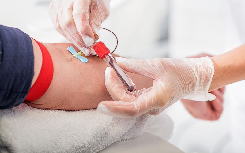 Uống nước lá gì để giảm mỡ máu? Bật mí một số loại lá làm sạch mỡ máu hiệu quả 1