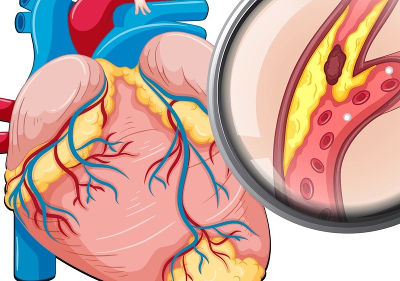 Uống nước lá gì để giảm mỡ máu? Bật mí một số loại lá làm sạch mỡ máu hiệu quả 2