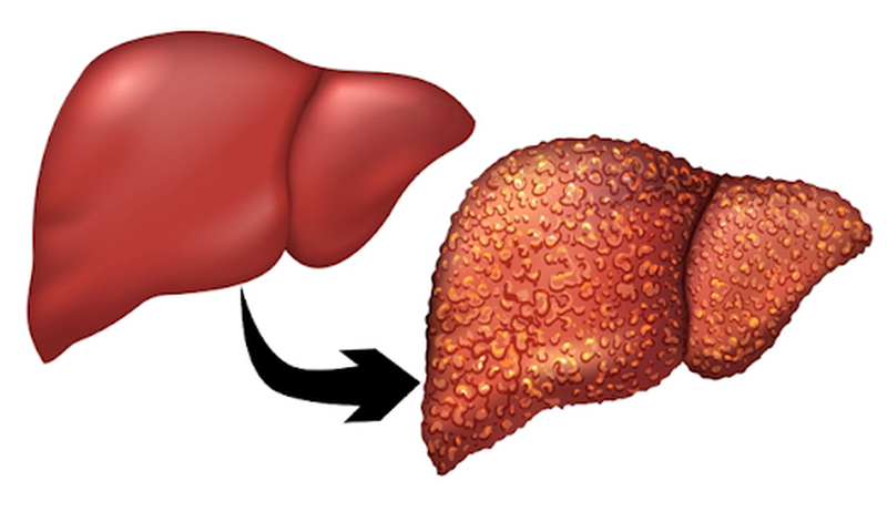 Giải độc gan như thế nào cho hiệu quả bạn đã biết chưa?
