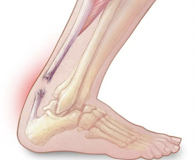 vai-tro-benh-ly-lien-quan-den-gan-la-gi 4