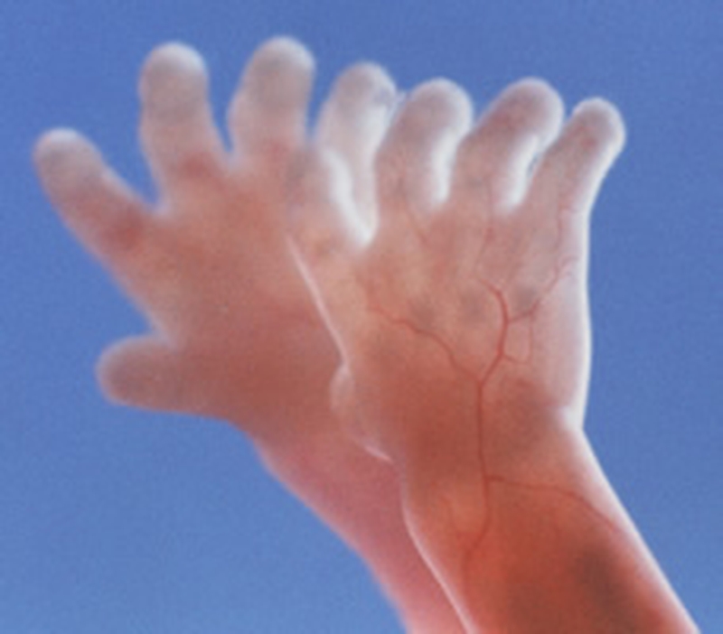 Vào tuần thứ 15, các miếng đệm ở bàn tay và bàn chân trở nên nhẵn nhụi hơn, và hình thành các vân tay 3