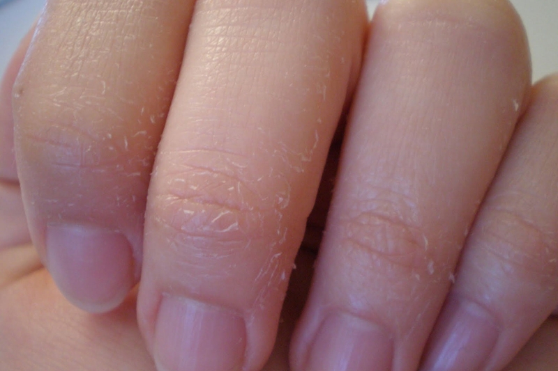 Vì sao da tay bị khô và cách cải thiện như thế nào 1