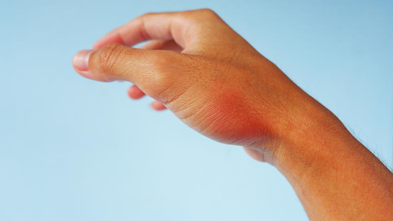 Viêm khớp ngón tay cái: Những thông tin bạn cần biết 3