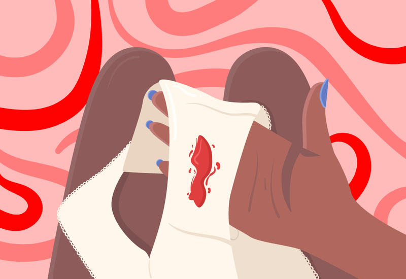 Viêm lộ tuyến cổ tử cung là gì? Nguyên nhân, triệu chứng, phòng ngừa và phương pháp điều trị 4