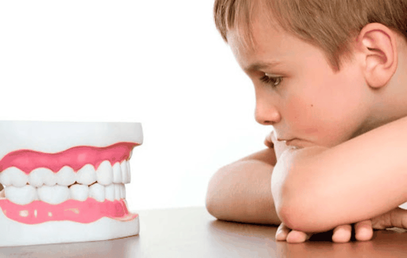 Viêm lợi khi niềng răng và cách điều trị 2.png