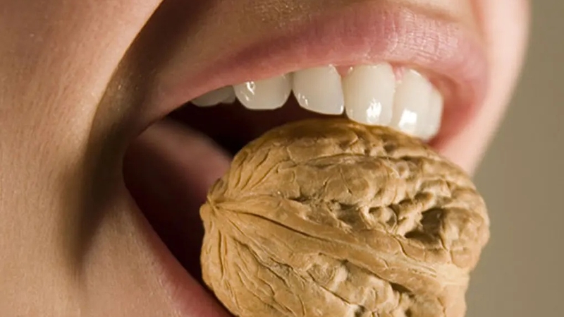 Trám răng tạm thời để làm gì và giữ được trong bao lâu? 4