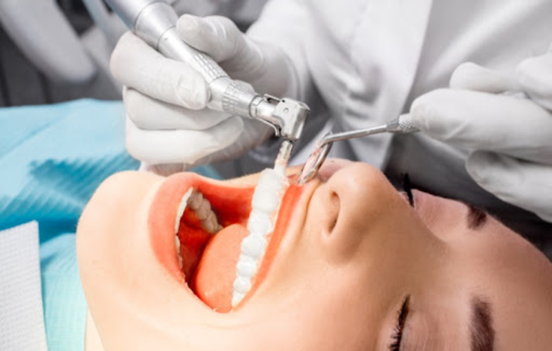 Viêm lợi sưng má là gì 4.png