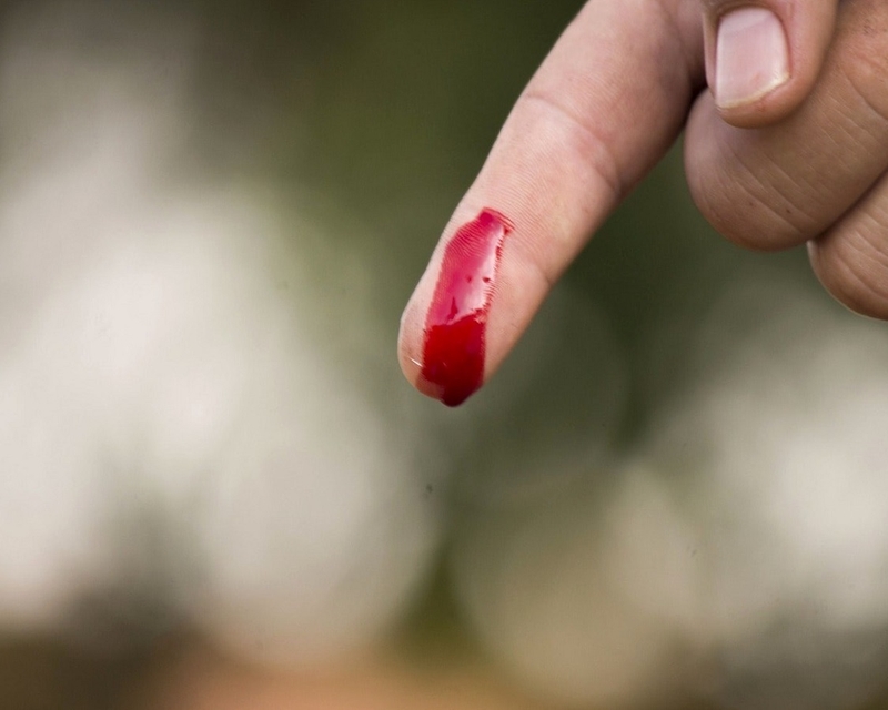 Vitamin K1 và K2 khác nhau gì về tác dụng? 3