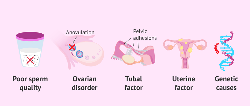 Vô sinh thứ phát 8.png
