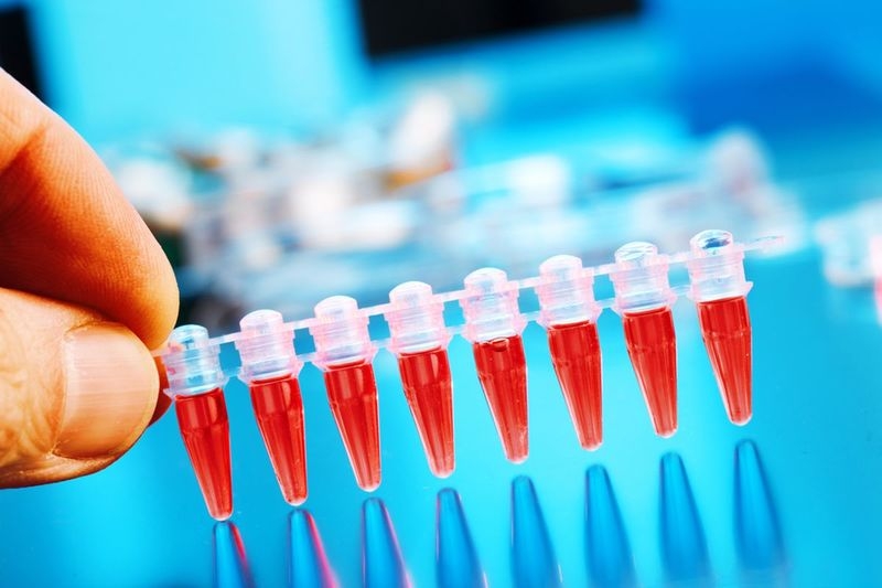 Xét nghiệm D - dimer là gì và những lưu ý khi thực hiện xét nghiệm 1