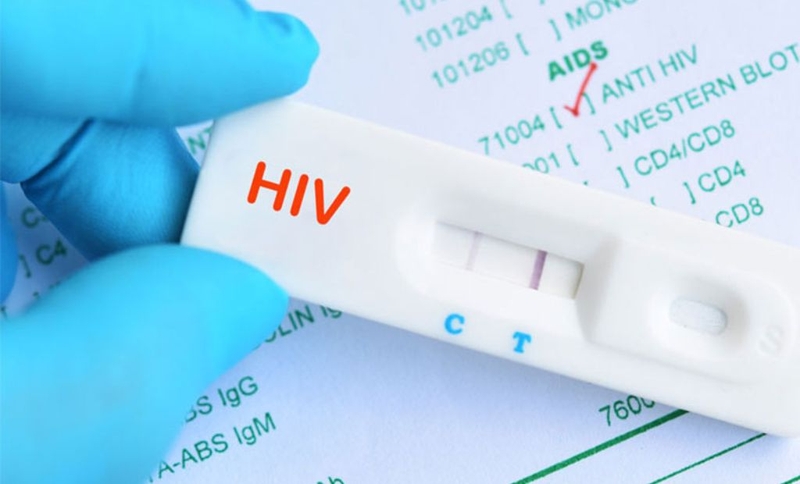 Xét nghiệm HIV nhanh là gì? Que test HIV có chính xác không? 2