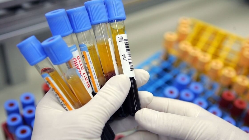 Xét nghiệm HbA1c có cần nhịn ăn? 2