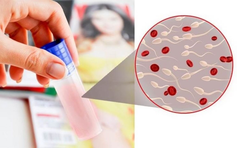 Xuất tinh là gì? Quy trình xuất tinh và yếu tố bất thường có thể xảy ra 4
