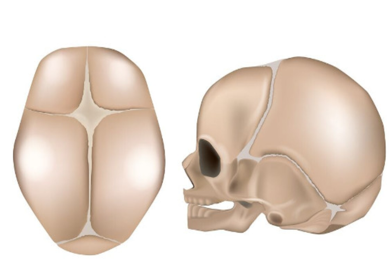 Xương lồi sau đầu ở trẻ sơ sinh có nguy hiểm không? 2.png