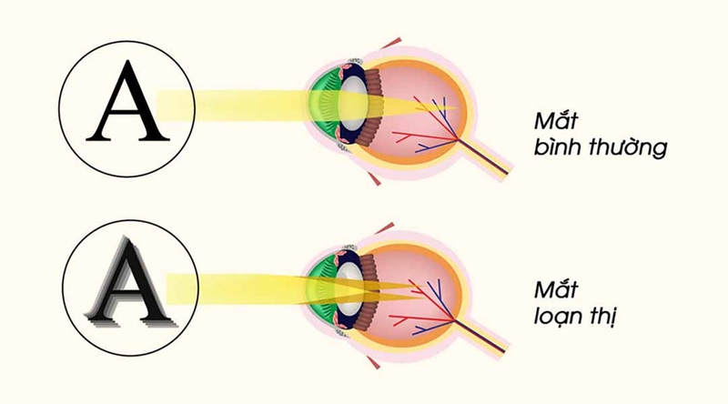 Top các thực phẩm tốt cho mắt loạn thị 1
