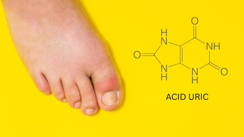 Acid uric là gì? Những điều bạn cần biết về acid uric 1