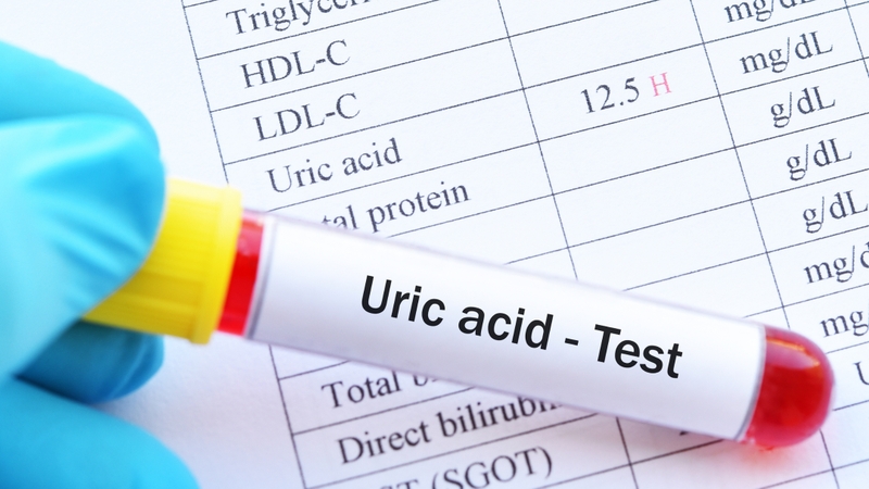 Acid uric là gì? Những điều bạn cần biết về acid uric 2