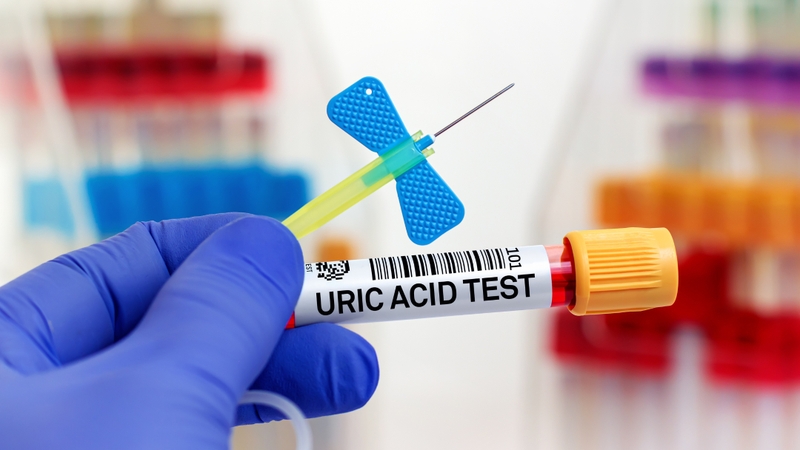 Acid uric là gì? Những điều bạn cần biết về acid uric 7