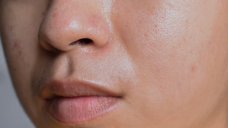 AHA BHA PHA là gì? Công dụng đối với làn da và cách sử dụng 2