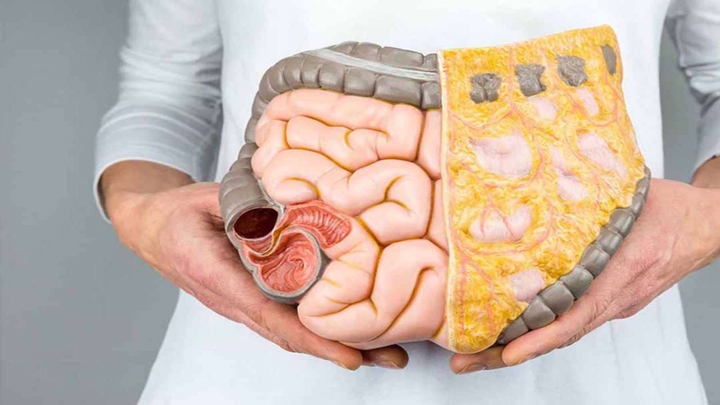 Ai không nên ăn hạt sen? Câu hỏi đơn giản nhưng ít người biết đáp án 03