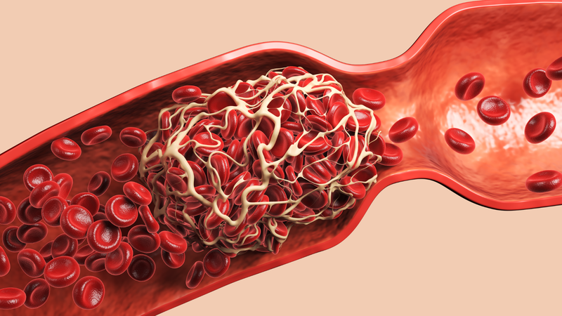Nồng độ estrogen cao có liên quan đến việc tăng nguy cơ hình thành cục máu đông