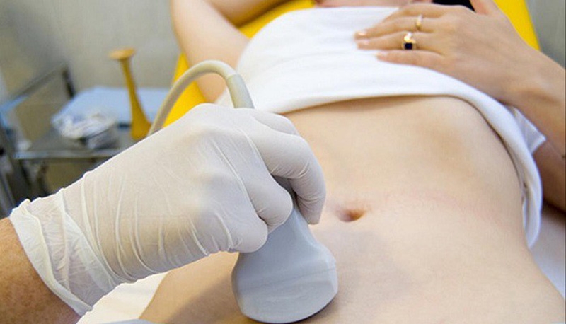 Tầm soát ung thư buồng trứng như thế nào?2