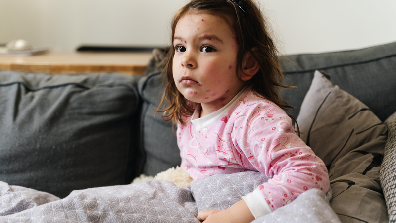 Ai tìm ra vắc-xin thủy đậu? Hiệu quả của vắc-xin thủy đậu 4