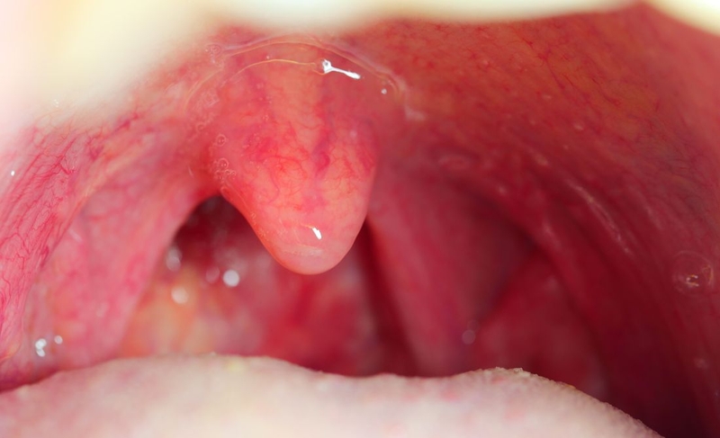 Amidan có tác dụng gì? Các vấn đề thường gặp với amidan 1