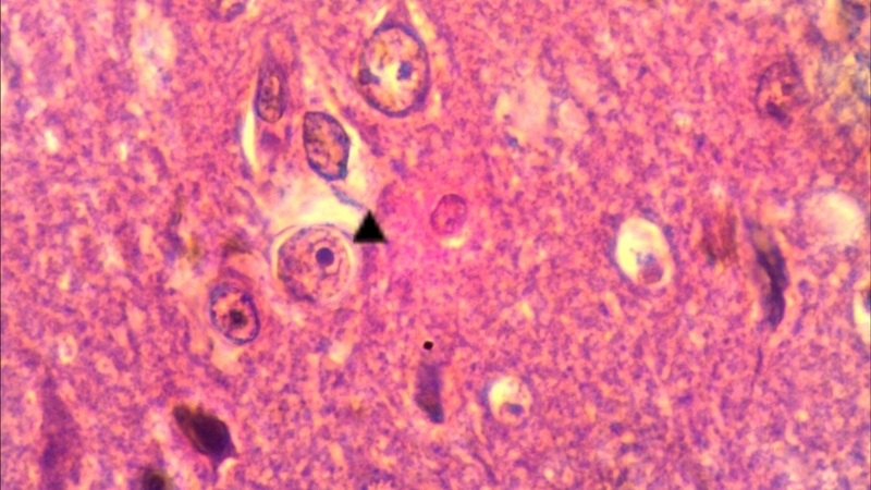 Amip ăn não lây nhiễm sang người như thế nào? Cách dự phòng bệnh 1