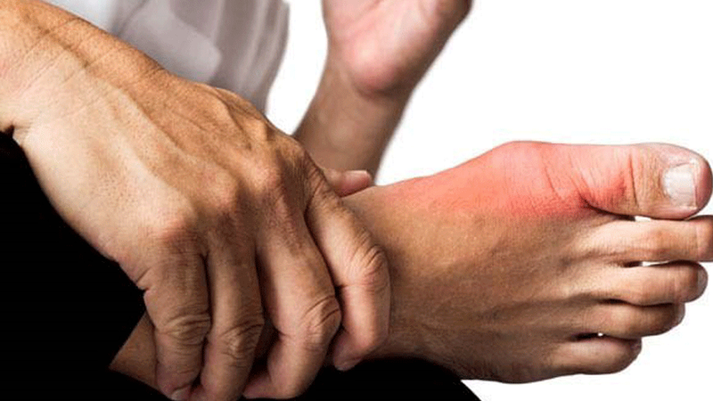 Ăn 3 loại bí này để giúp hỗ trợ hạ axit uric trong máu 1