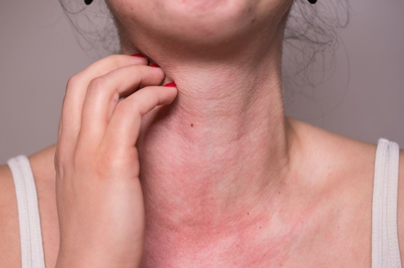 Ăn cá mực có tác dụng gì? Nguy cơ tiềm ẩn khi ăn mực 4