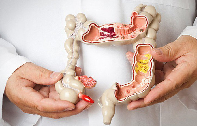 Ăn dưa muối có gây ung thư? Làm thế nào để ăn dưa muối an toàn? 3