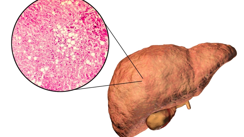 Ăn gừng có tốt cho gan? Lợi ích và những lưu ý bạn cần biết-2