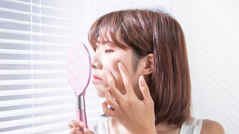 Ăn hạnh nhân có nổi mụn không? Ăn hạnh nhân thường không phải là nguyên nhân trực tiếp gây nổi mụn