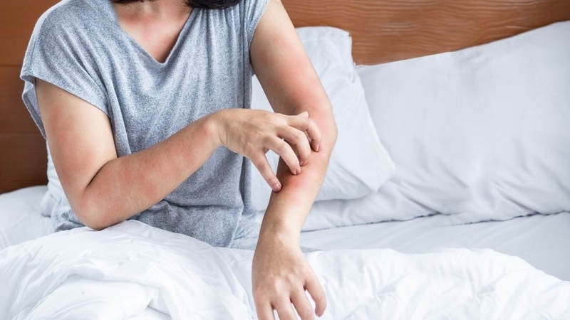 Người cơ địa dị ứng nên cẩn trọng khi ăn hạt điều