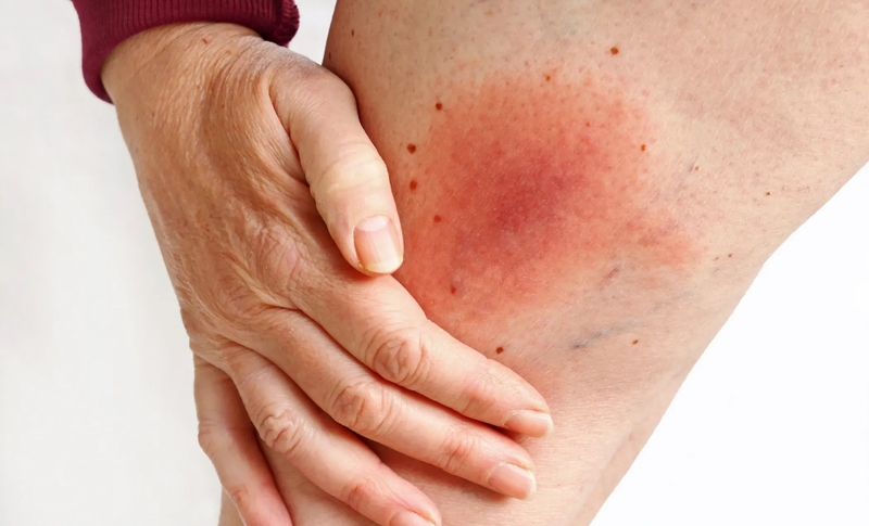 Ăn hoa chuối có tốt không? Cần lưu ý gì khi sử dụng? - 2