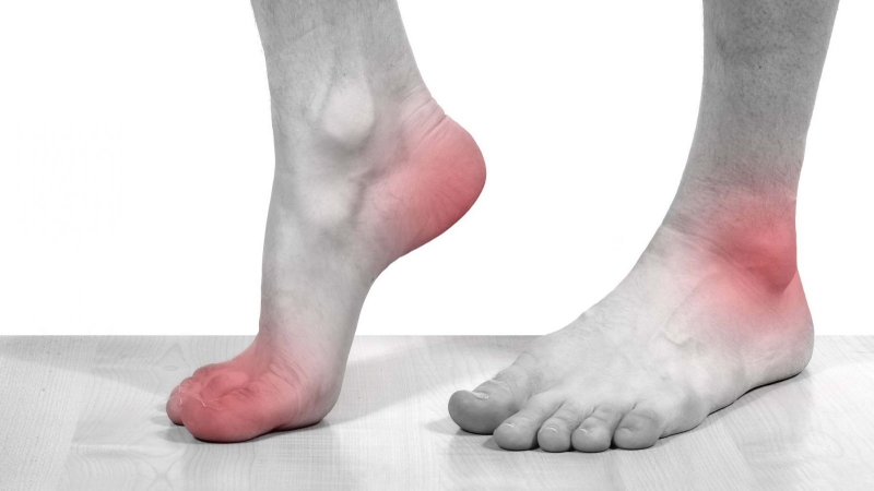 Ăn nem chua có tốt không? Ai không nên ăn nem chua? 4