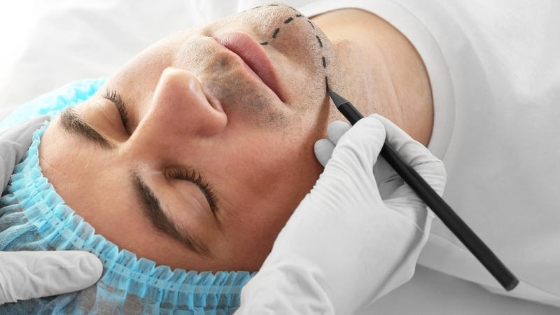 Ăn nếp có bị sẹo lồi không và bao lâu mới được ăn nếp? 2