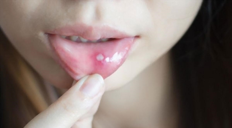 Ăn nhãn có nóng không? Những lưu ý mà bạn nên biết khi ăn nhãn 2