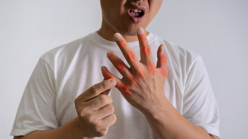 Nên đi khám nếu xuất hiện cơn đau khớp đột ngột và dữ dội
