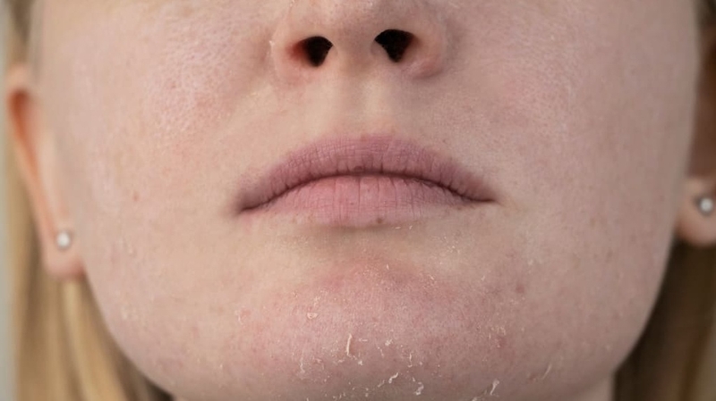 Ăn nhiều muối bị gì? Cách bổ sung lượng muối an toàn cho cơ thể 2