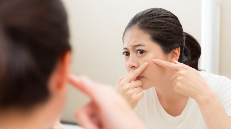 Không nên tự ý nặn mụn vì hành động này có thể làm tổn thương da