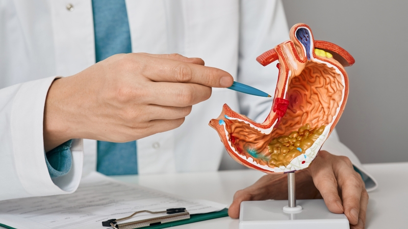 Người mắc viêm loét dạ dày nên hạn chế ăn ớt