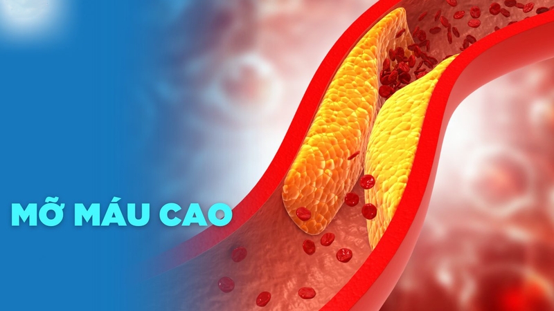 Ăn rau cần tây có tác dụng gì? 3