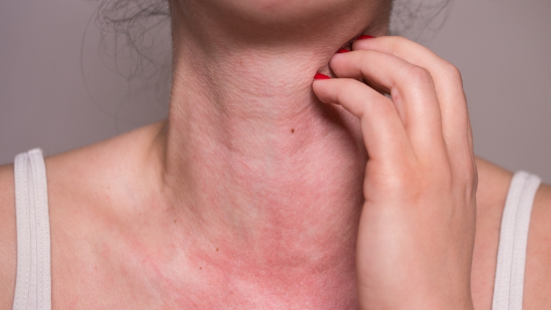 Ăn sữa chua có tác dụng gì? Ăn nhiều sữa chua có tốt không? 6