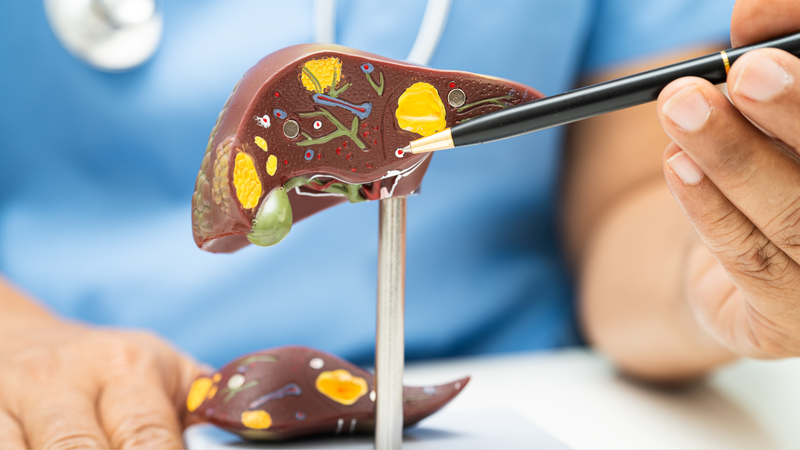 Dư fructose gây ảnh hưởng đến chức năng gan