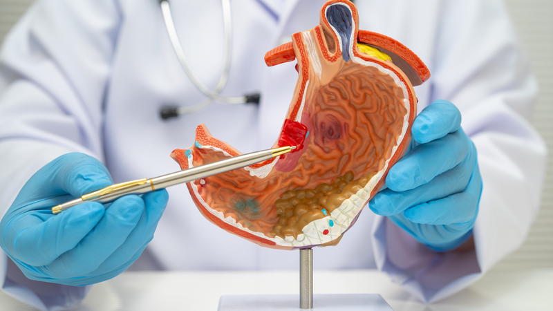 Ăn vào là đau bụng âm ỉ có thể do viêm loét dạ dày