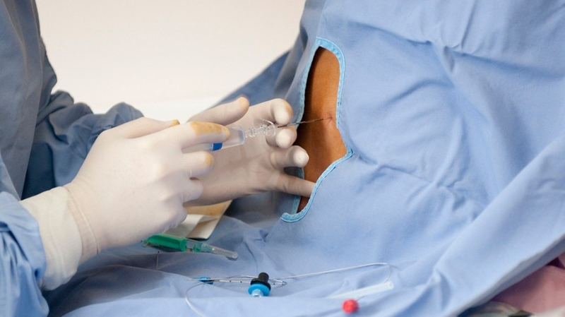 Anaesthesia là gì? Tìm hiểu về các loại gây mê và ứng dụng trong y khoa 1