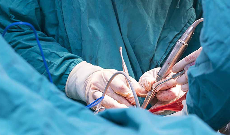 Phẫu thuật cắt bỏ tuyến tiền liệt