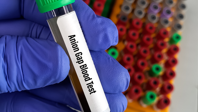 Anion gap là gì? Quá trình thực hiện xét nghiệm máu anion gap 4